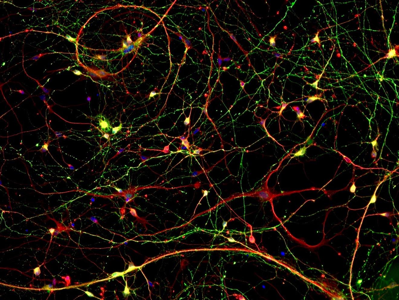 Differentiating patient-derived pluripotent stem cells into neurons (labelled in red, nuclei in blue) allows scientists to study mechanisms behind Alzheimer's Disease, including detrimental accumulation of phosphorylated tau protein (labelled in green)