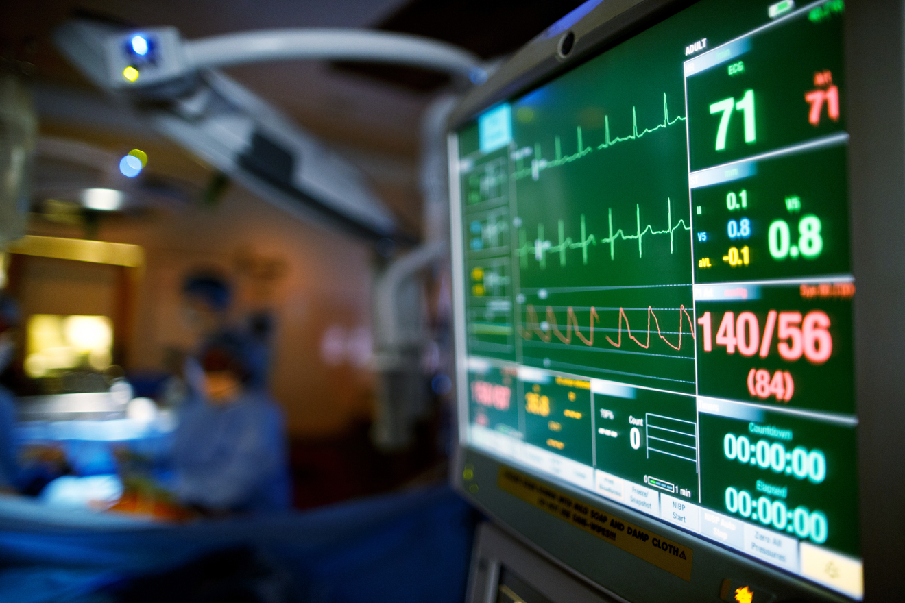 close up of a medical vital signs monitor in a hospital with clinicians in the background